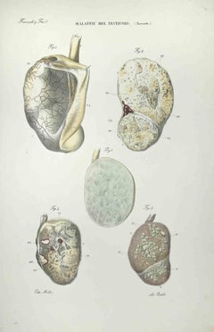 Antique Testicular Diseases - Lithograph By Ottavio Muzzi - 1843