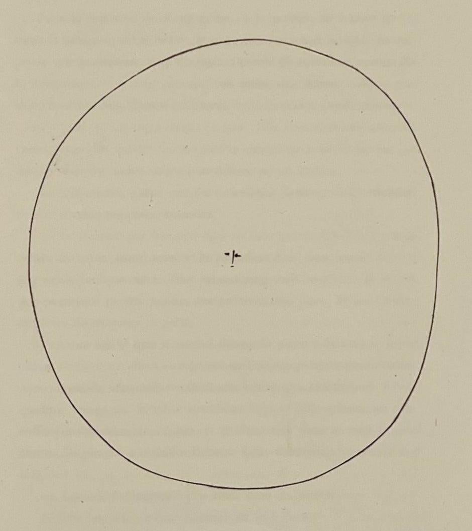 Pablo Picasso Print - Round Head of a Man with Tiny Features (Plate XVII), from Carmen