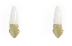 Pair of Mid-Century Modern Bathroom Wall Lights by Wilhelm Wagenfeld, 1960s