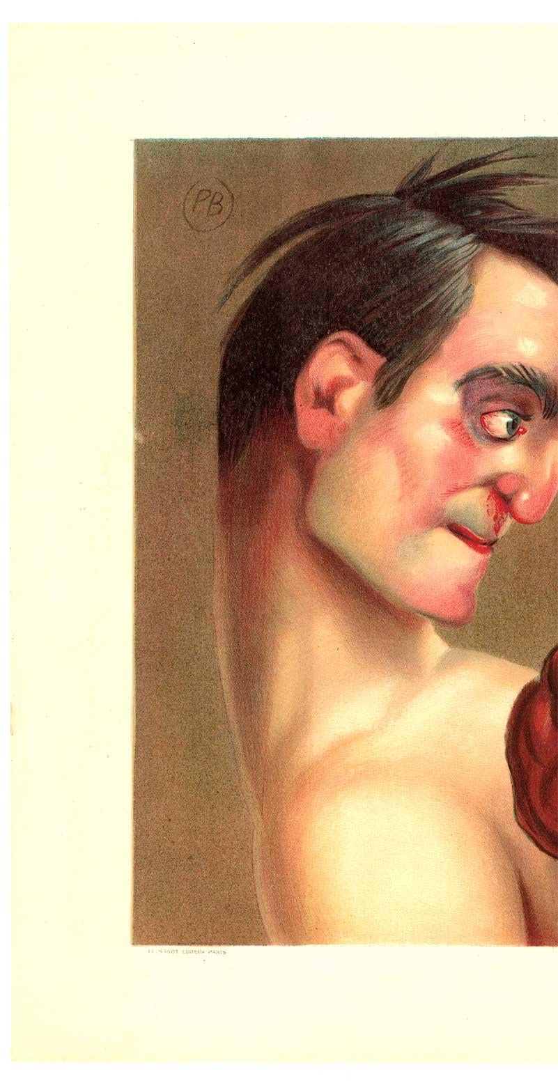 Original Le Boxer Caricature vintage French antique lithograph sports poster - Art Deco Print by Paul Baroni