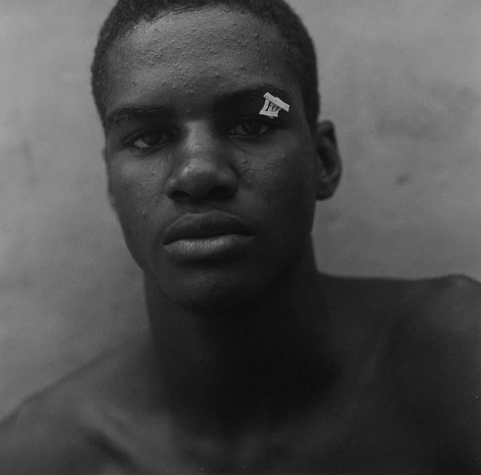 Paul Meleschnig Portrait Photograph - Untitled (Boxer with Butterfly Bandage)
