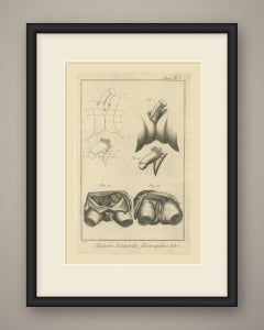 Pelvic Anatomy Studies, Diderot Hermaphrodites Supplement Plate 3, circa 1778