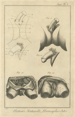 Pelvic Anatomy Studies, Diderot Hermaphrodites Supplement Plate 3, circa 1778