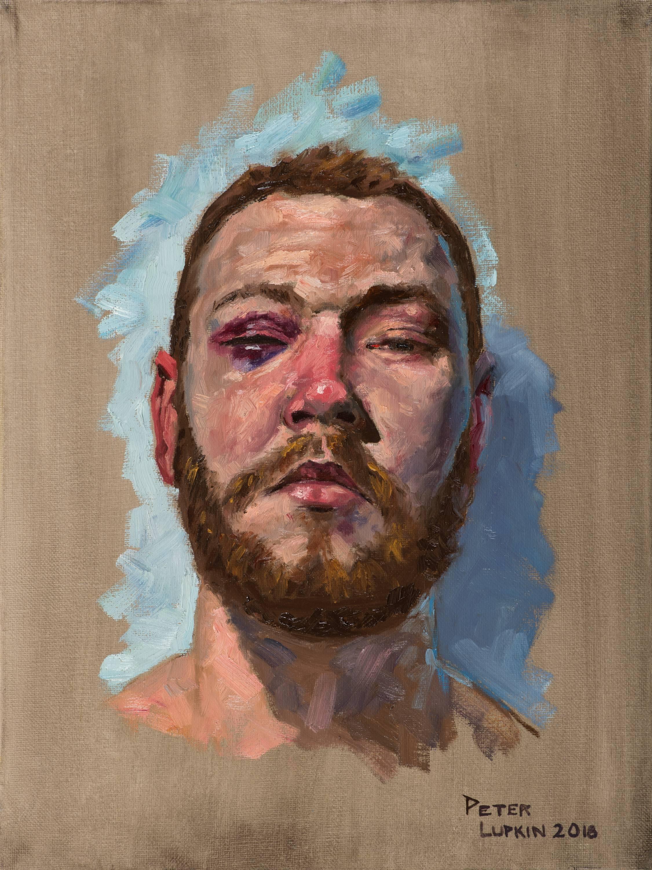 Peter Lupkin Figurative Painting – TJ, Porträt eines männlichen Boxers mit zwei schwarzen Augen, blauer und beigefarbener Hintergrund
