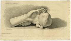 Waarneming over eene ongemeene wanstaltigheid aan de vingers van beide de handen