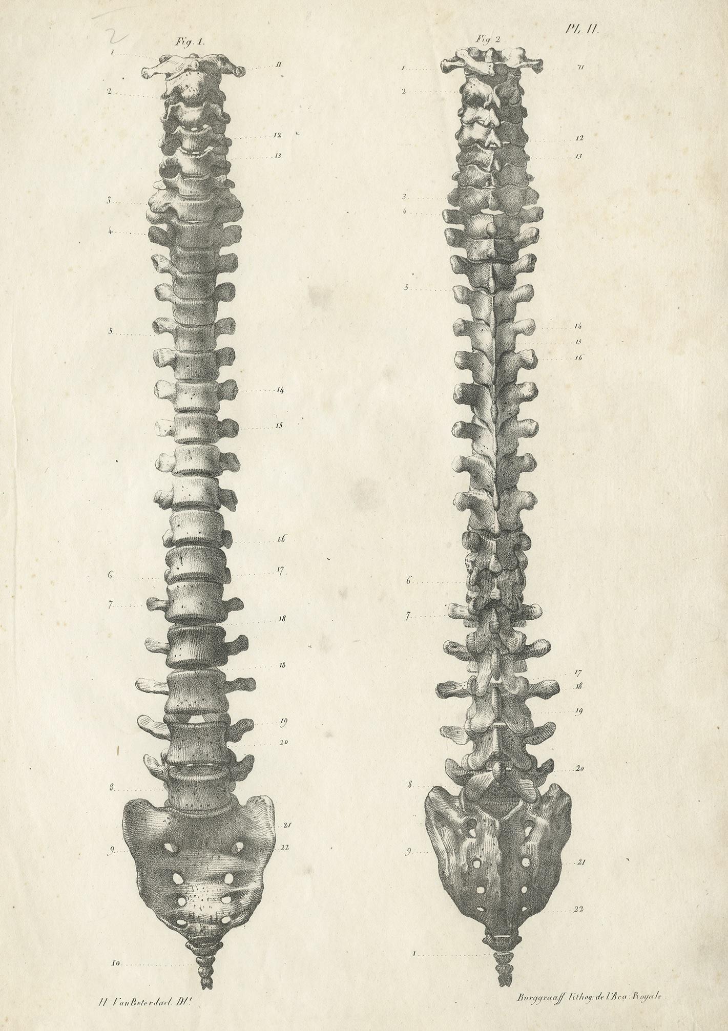 Pl. II Antique Anatomy / Medical Print of the Spine by Cloquet '1821 ...