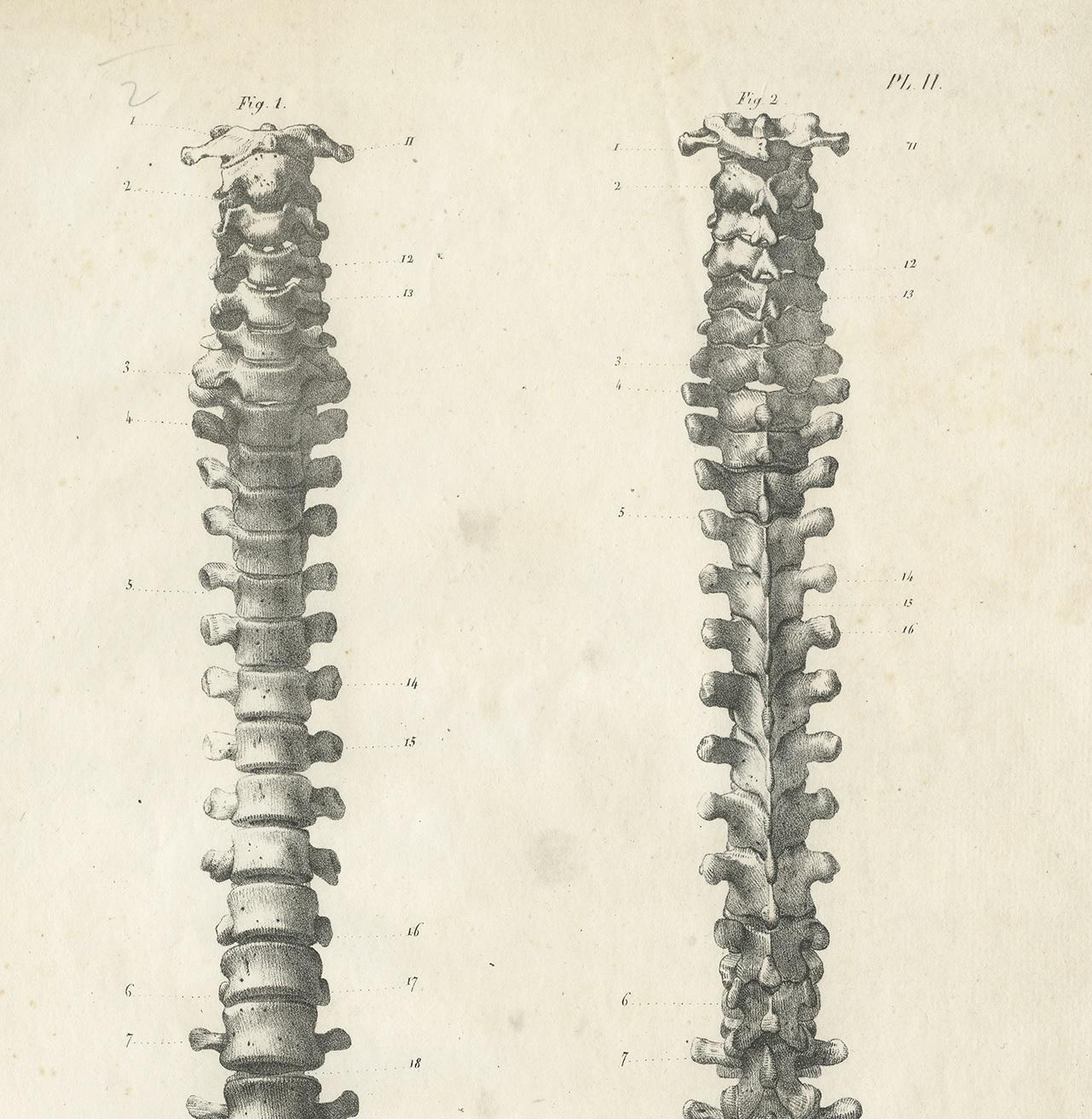 vintage spine