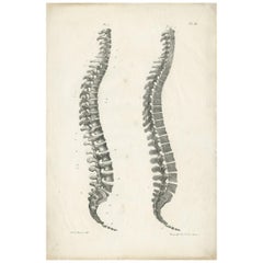 Pl. III Antique Anatomy / Medical Print of the Spine by Cloquet '1821'