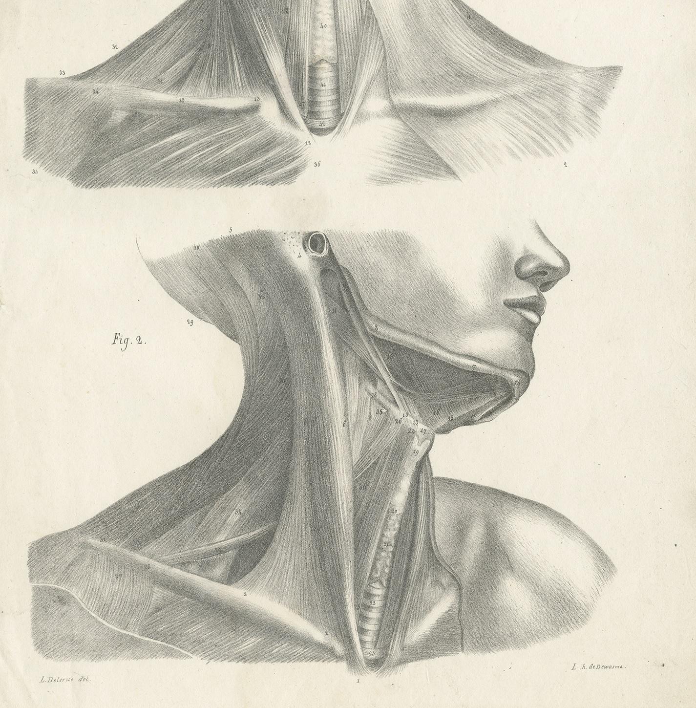19th Century Pl. LXIV Antique Anatomy / Medical Print of the Neck muscles by Cloquet, '1821' For Sale