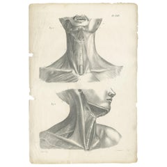 Pl. LXIV Antique Anatomy / Medical Print of the Neck muscles by Cloquet:: '1821'