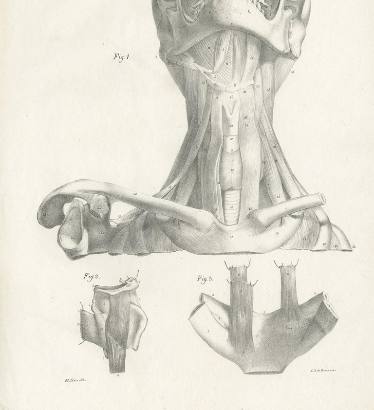 Pl. LXV Antique Anatomy / Medical Print of the Neck Muscles by Cloquet ...