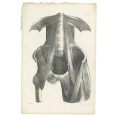 Pl. LXXIX Antique Anatomy / Medical Print of the Thigh by Cloquet '1821'