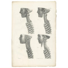 Pl. LXXXVI Antique Anatomy / Medical Print of the Spine by Cloquet '1821'