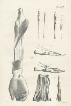 Pl. LXXXXIV Antique Anatomy / Medical Print of the Forearm by Cloquet, 1821