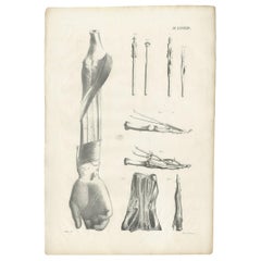 Pl. LXXXXIV Antique Anatomy / Medical Print of the Forearm by Cloquet, 1821
