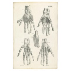 Pl. LXXXXVI Antique Anatomy / Medical Print of Hand Muscles by Cloquet, '1821'