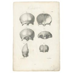 Pl. XII Antique Anatomy / Medical Print of the Skull by Cloquet, '1821'