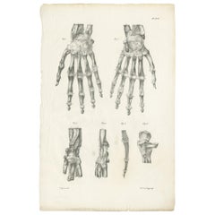 Pl. XLII Antique Anatomy / Medical Print of the Hand by Cloquet '1821'