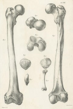 Antique Anatomy / Medical Print of the Femur Bones by Cloquet, '1821'