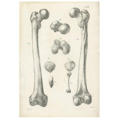 Antique Anatomy / Medical Print of the Femur Bones by Cloquet, '1821'