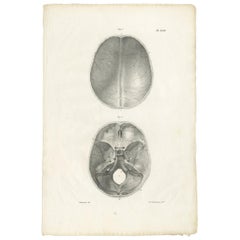 PL. XVIII Antique Anatomy / Medical Print of the Skull by Cloquet, 1821