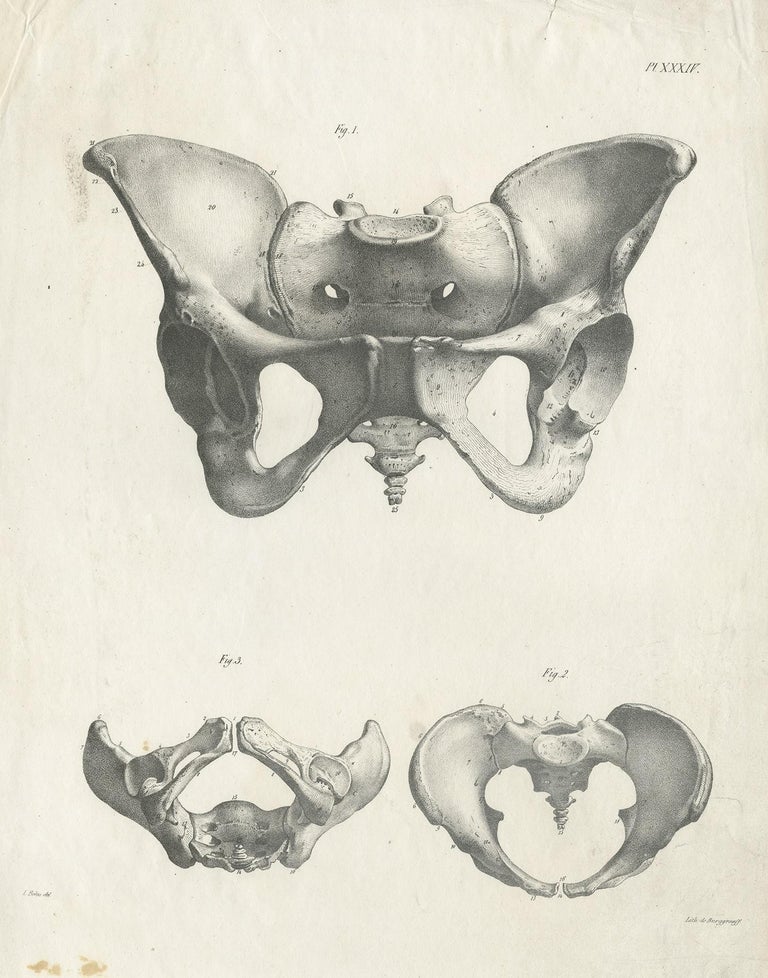 Pl. XXXIV Antique Anatomy / Medical Print of the Pelvis by Cloquet ...