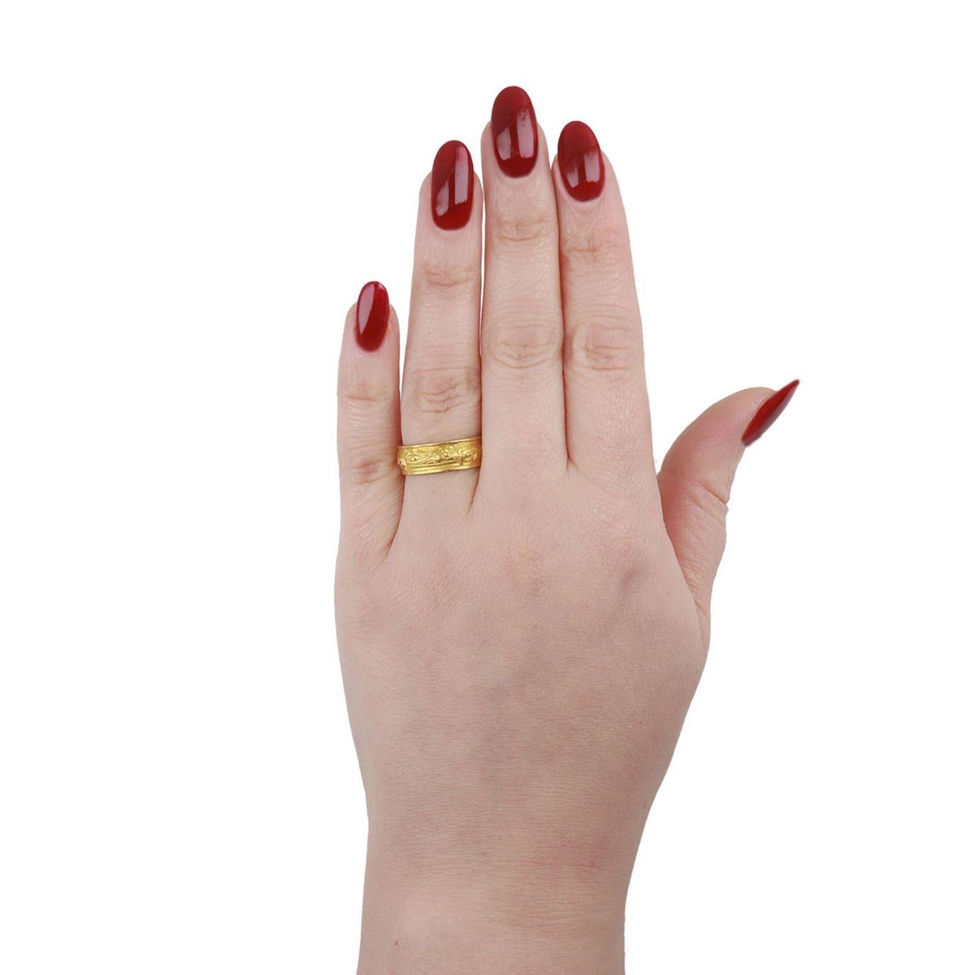 Anello post medievale, 