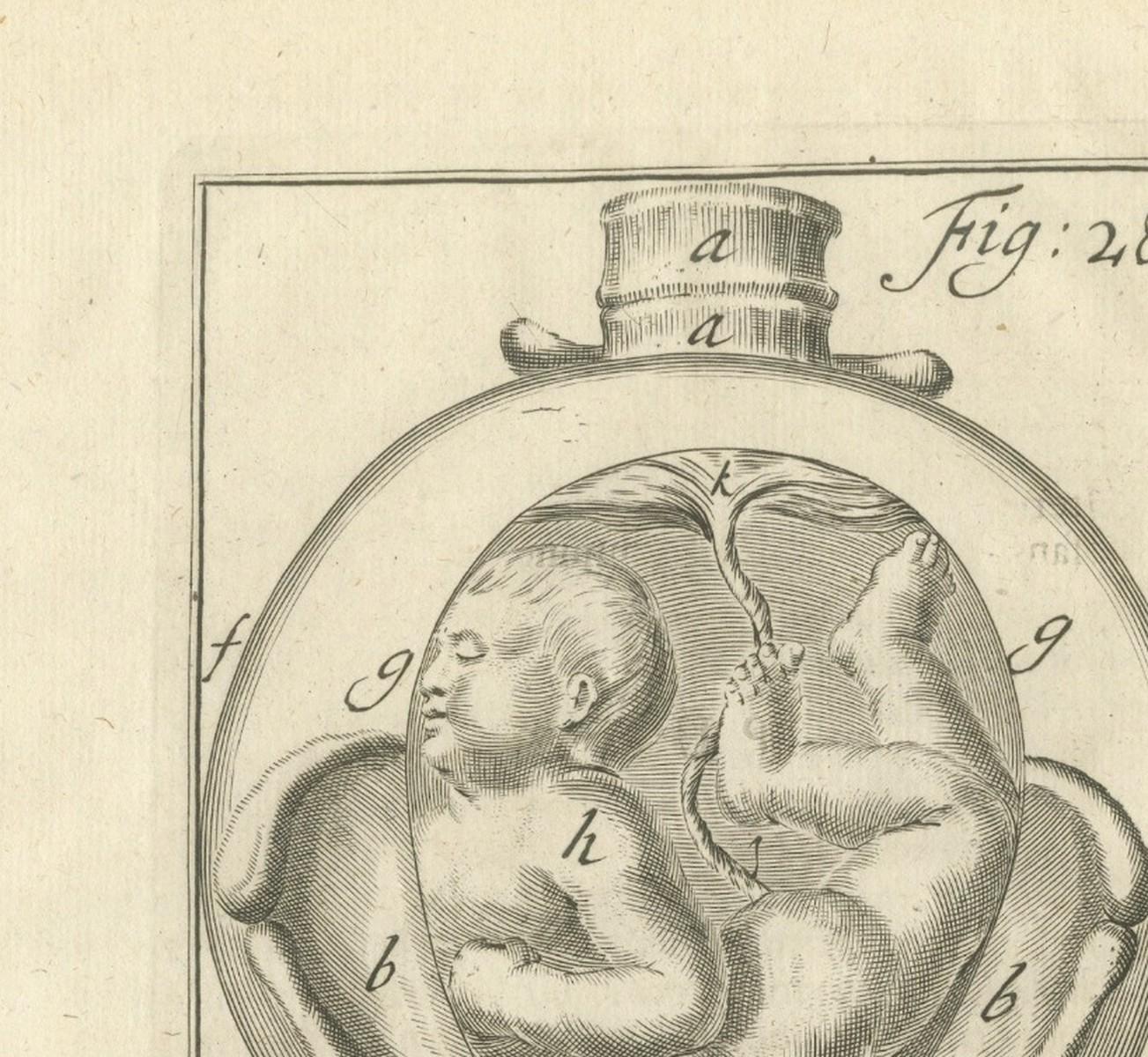 Pregnancy & Fetal Position – Antique Obstetric Engravings, Van Deventer, 1734