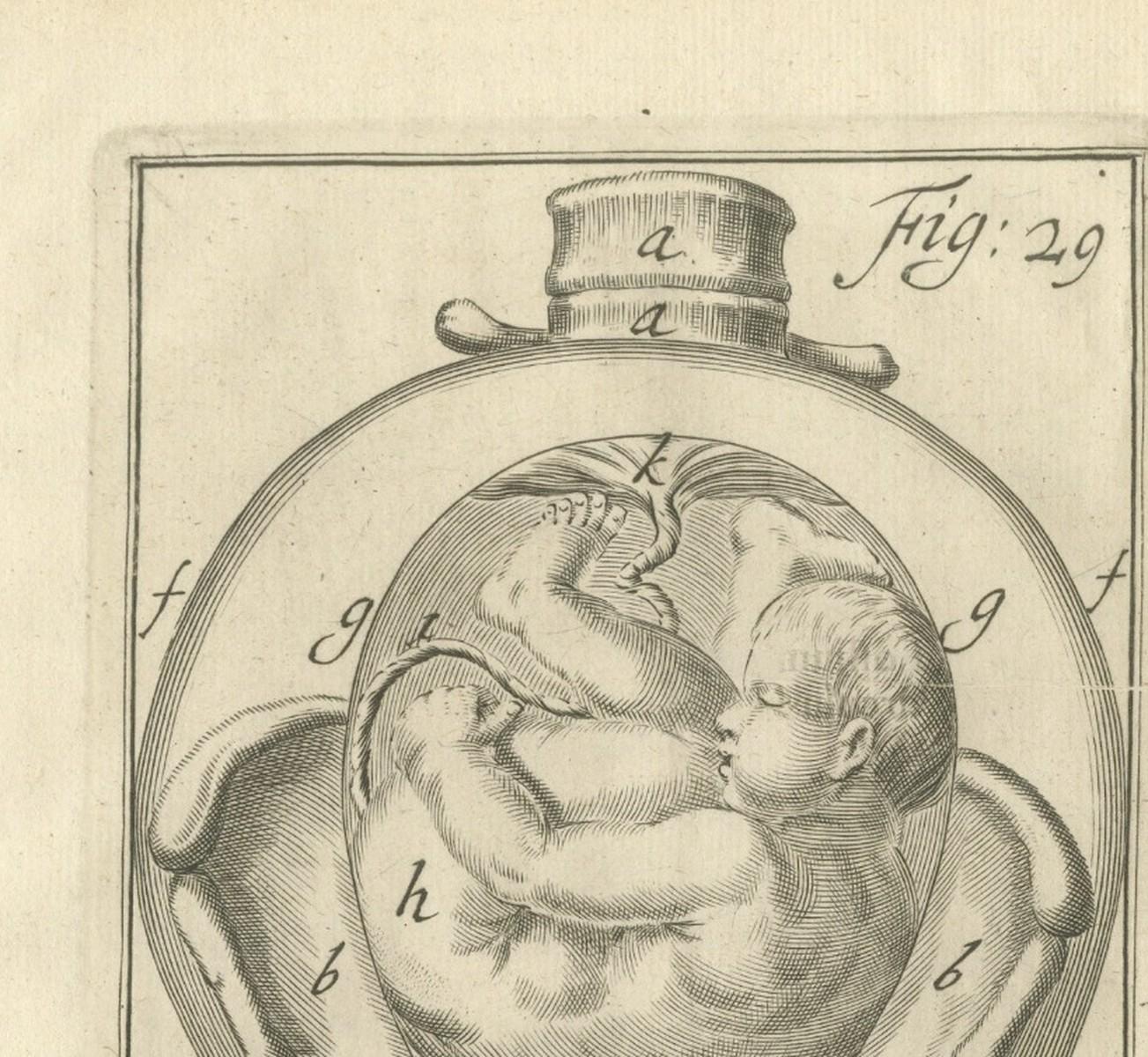 Pregnancy & Fetal Position – Antique Obstetric Engravings, Van Deventer, 1734
