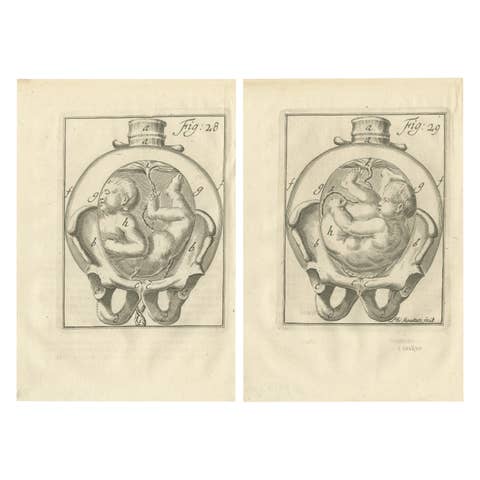 Pregnancy & Fetal Position – Antique Obstetric Engravings, Van Deventer, 1734