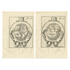 Pregnancy & Fetal Position – Antique Obstetric Engravings, Van Deventer, 1734