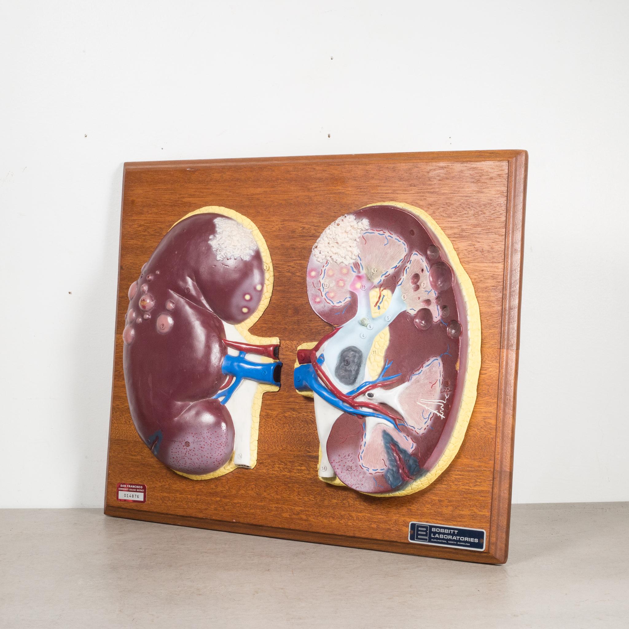 About

A detailed model of a human kidneys mounted on a wooden plaque. Used for medical training, each part of the kidneys are numbered probably corresponding to a text book. The piece has retained its original finish and is in good condition with