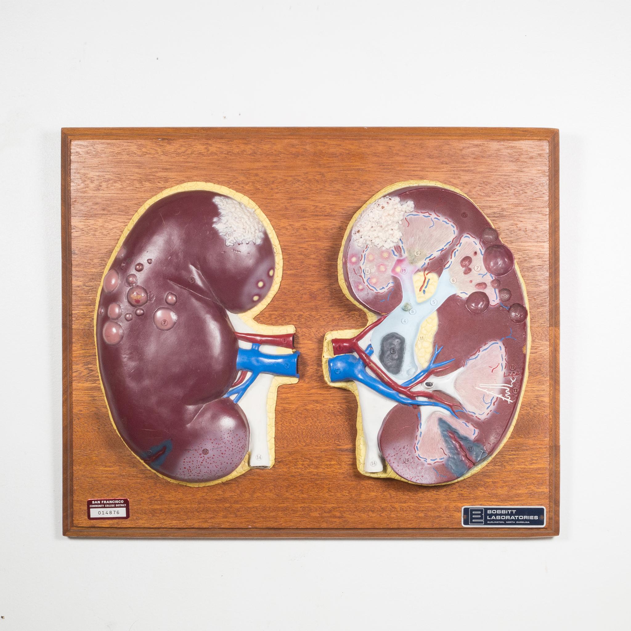Professional Medical Teaching Display of Human Kidneys c.1950 In Good Condition In San Francisco, CA