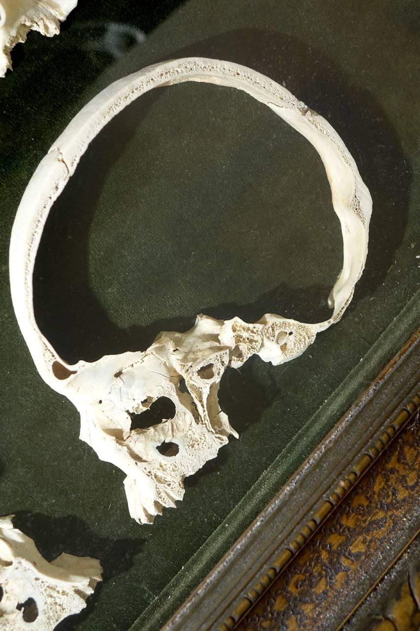 Victorian Rare Antique 1800s Sagittal Sectioned Skull