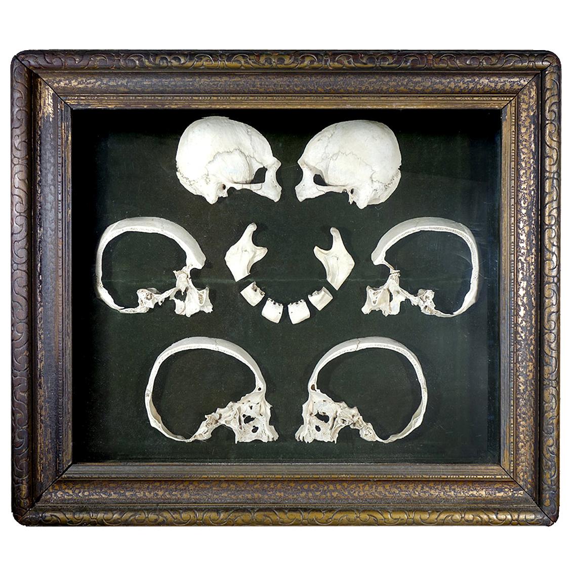 Rare Antique 1800s Sagittal Sectioned Skull