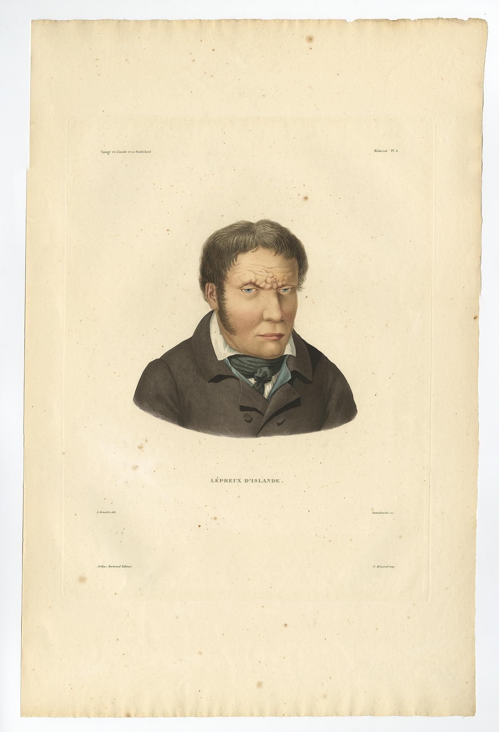 Français Rare ensemble de trois estampes anciennes d'Islande - Lepers, Gaimard Voyage, 1842 en vente