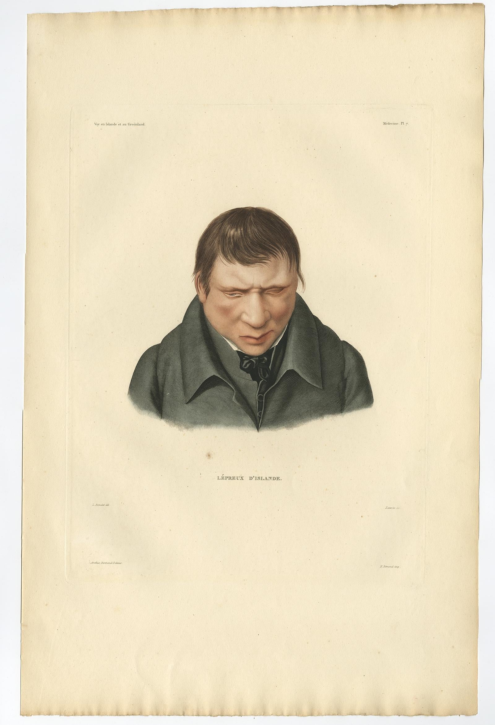 Rare ensemble de trois estampes anciennes d'Islande - Lepers, Gaimard Voyage, 1842 Bon état - En vente à Langweer, NL