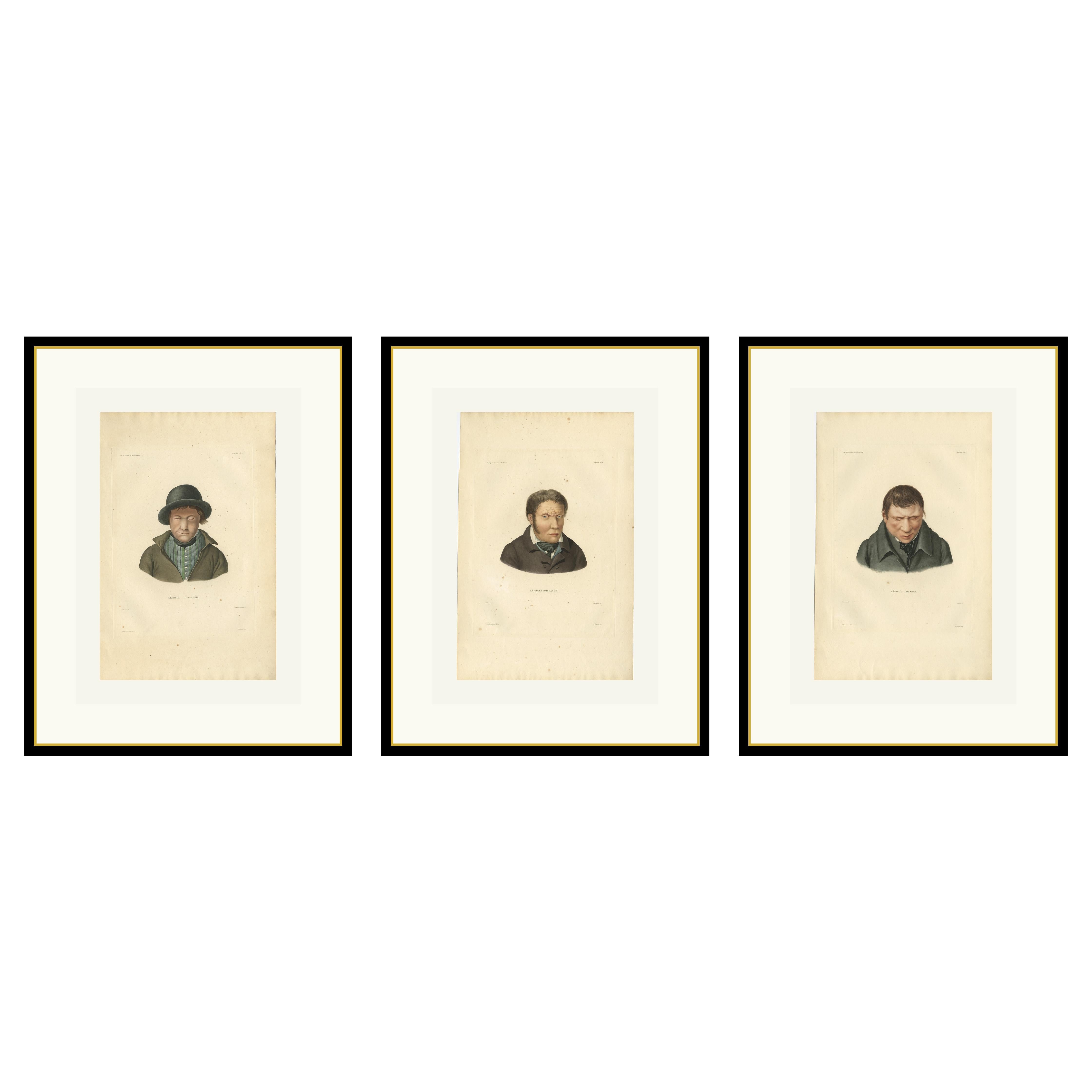 Raro set di tre antiche stampe islandesi - Lebbrosi, Gaimard Voyage, 1842
