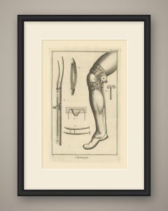Ratcheted Leg Brace and Splint, Diderot Chirurgie Plate XXXIII, circa 1772