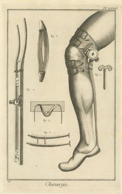 Ratcheted Leg Brace and Splint, Diderot Chirurgie Plate XXXIII, circa 1772