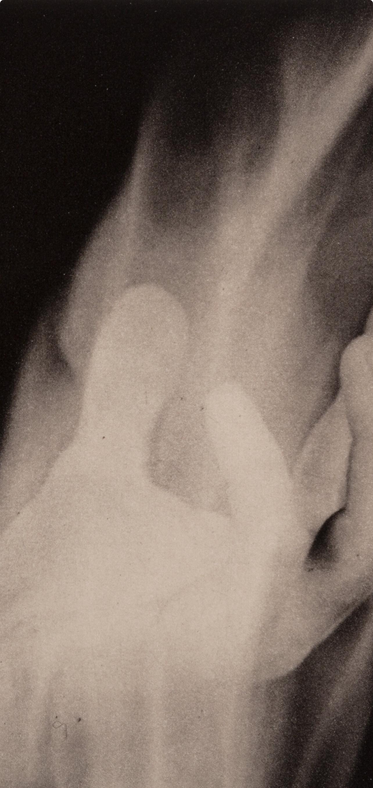 Mapplethorpe, Hand in Fire, A Season in Hell (dopo) - Photograph Contemporaneo di Robert Mapplethorpe