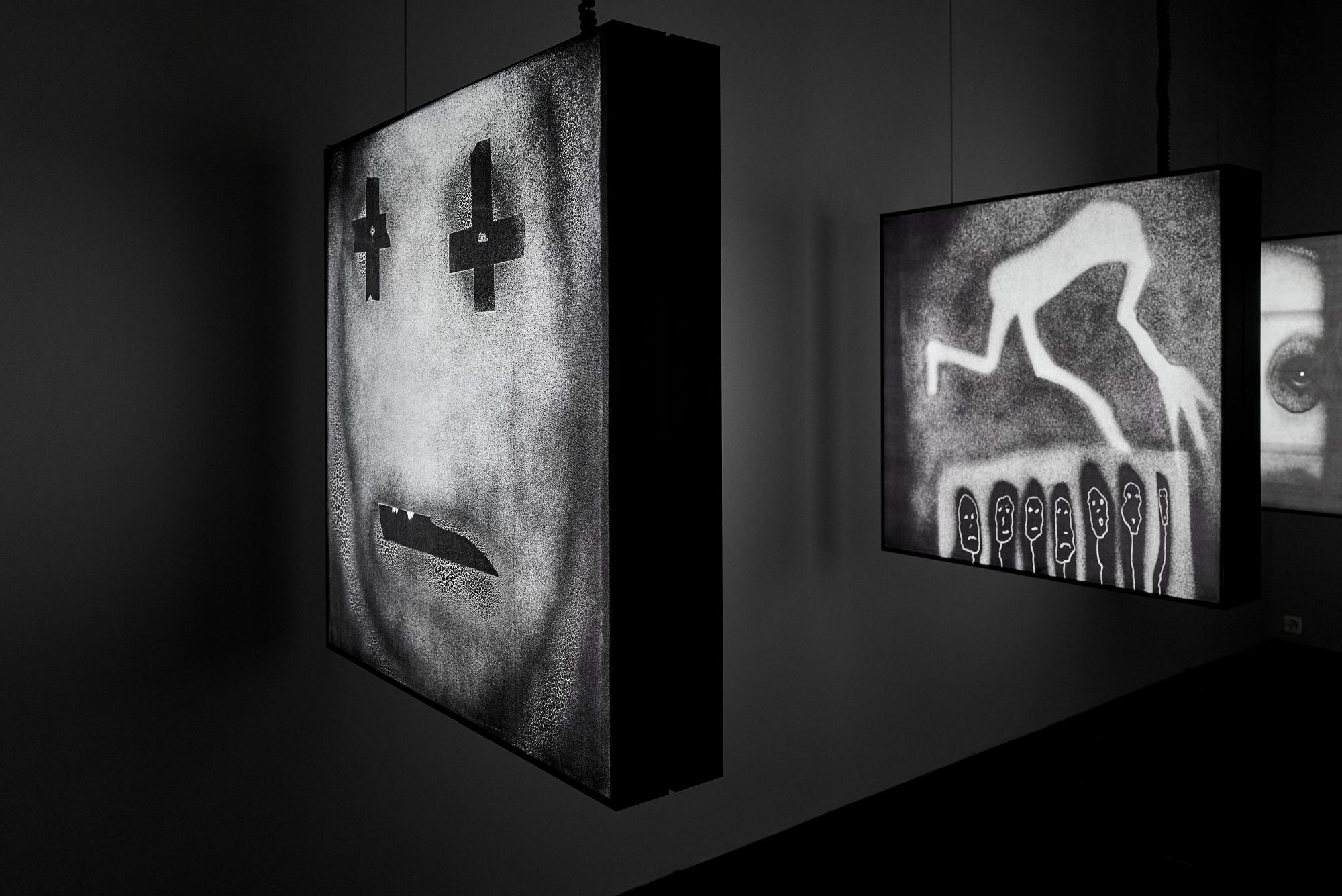 Injured – Roger Ballen, Black and White, Staged, Lightbox, Venice Biennale For Sale 1