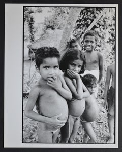 Undernourished children in India, 1950s - 1960s.