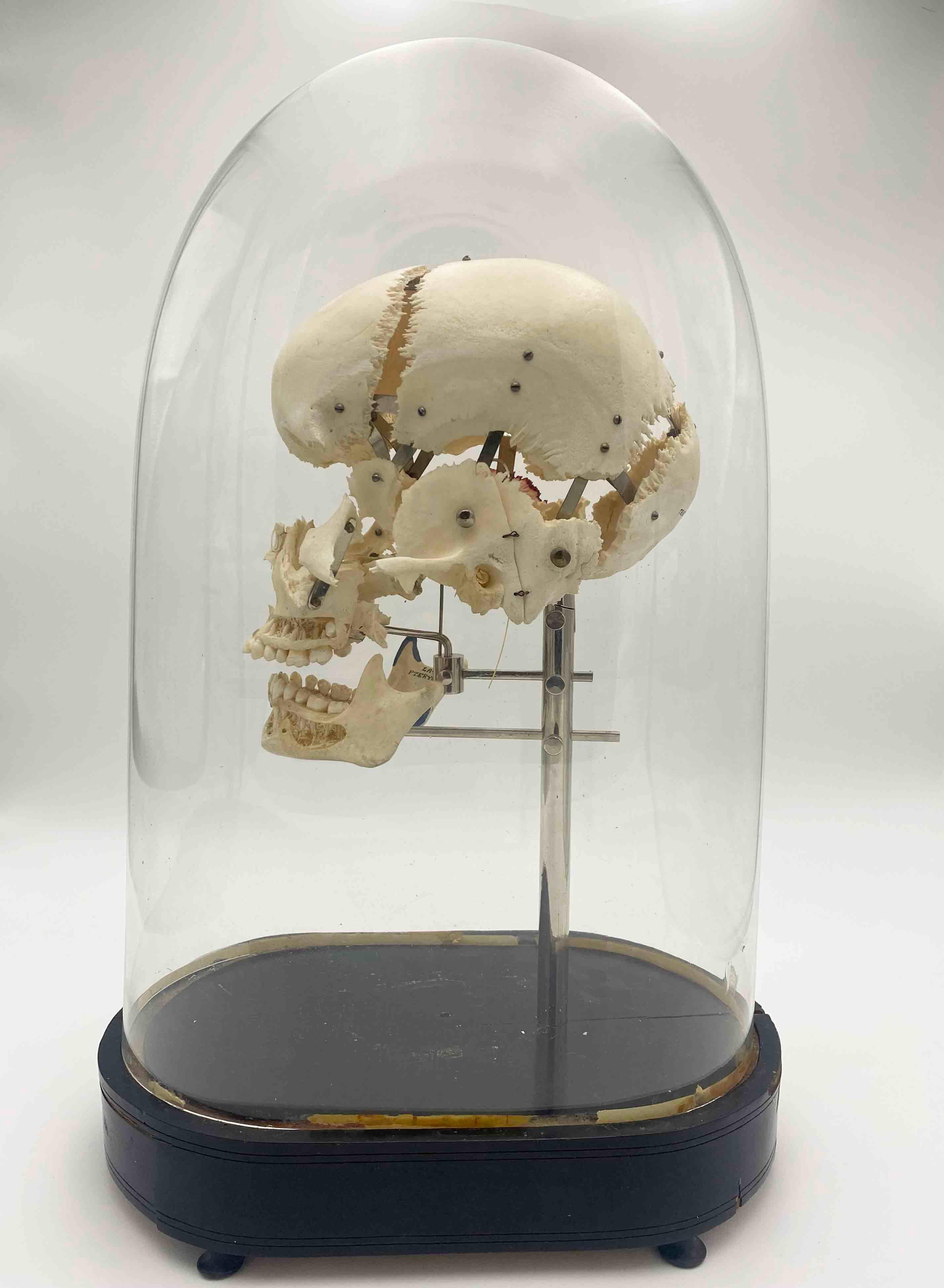 Authentic Exploding Skull

Originally created by Edmé François Chauvot de Beauchêne (ca.1780-1830), a French anatomist and

surgeon, developed this disarticulation method to comprehensively show all the

cranial bones and their