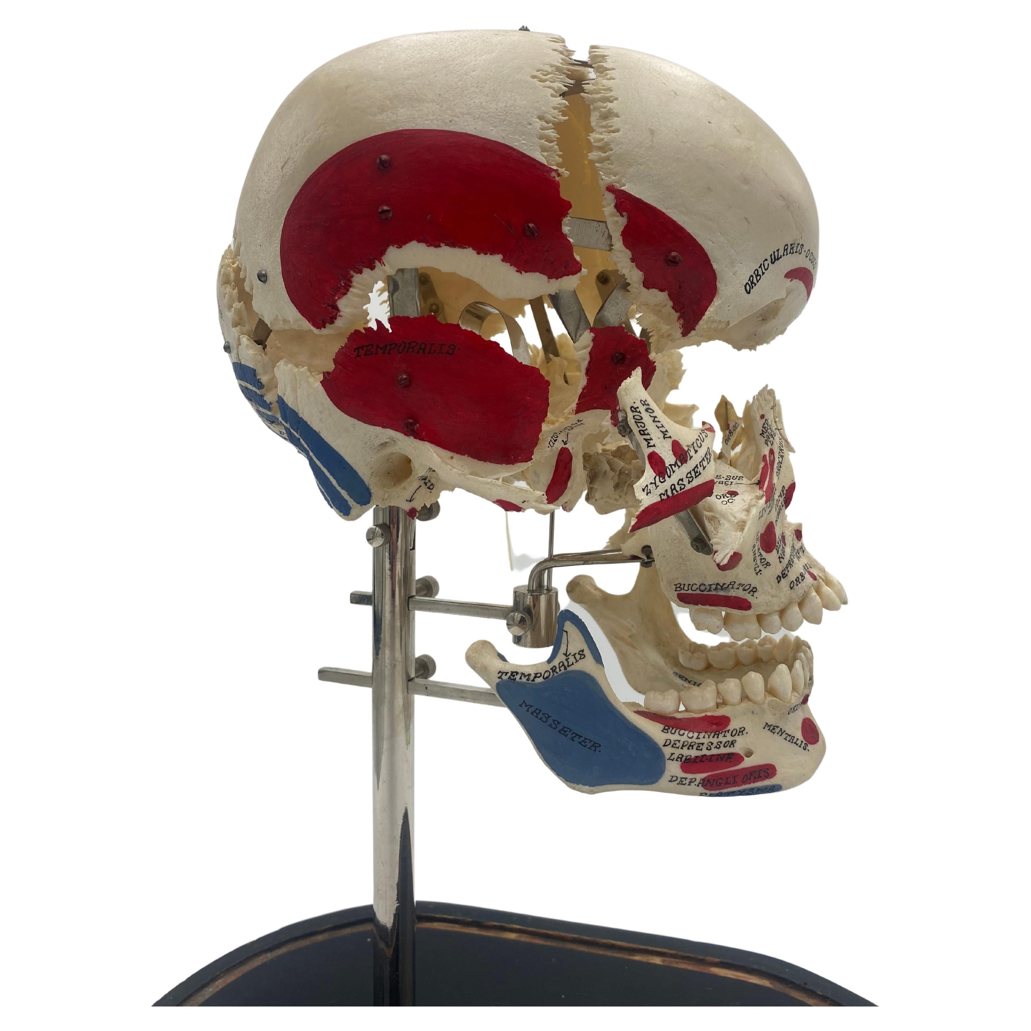 Seldom Seen Authentic Exploding Skull, Medical, After Claude Beauchêne For Sale