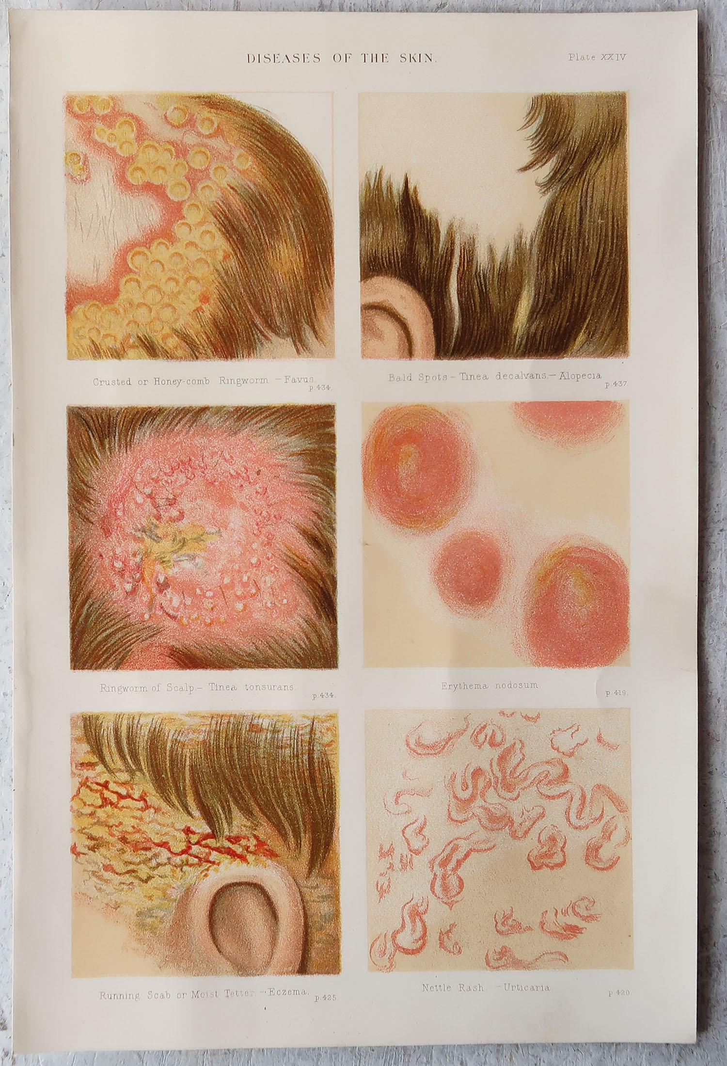 Other Set of 4 Original Vintage Medical Prints, C.1900 For Sale