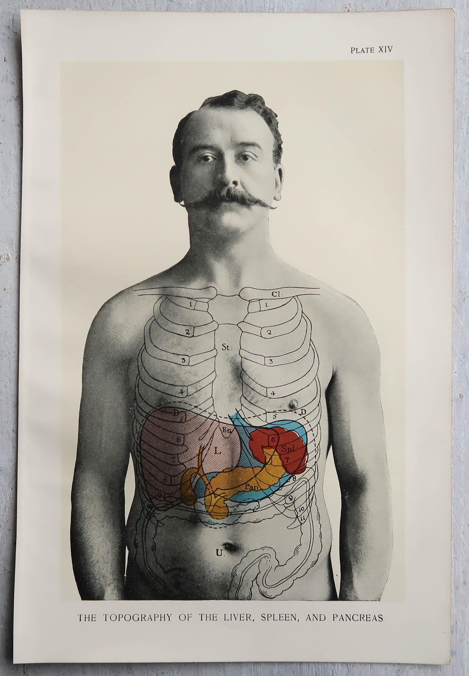 Set of 8 Original Vintage Medical Prints, circa 1900 1