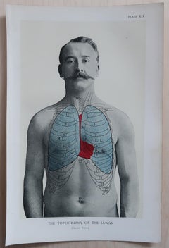 Set of 8 Original Vintage Medical Prints, circa 1900