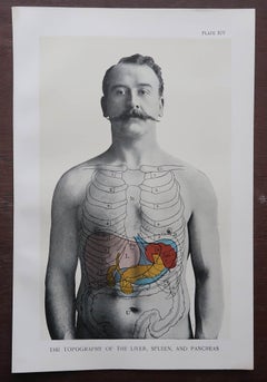 Set of 8 Original Vintage Medical Prints, circa 1900