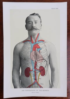 Set of 8 Original Vintage Medical Prints, circa 1900